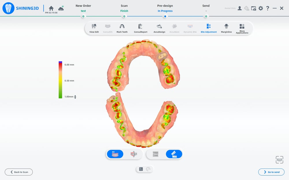 Shining 3D Aoralscan 3 Light