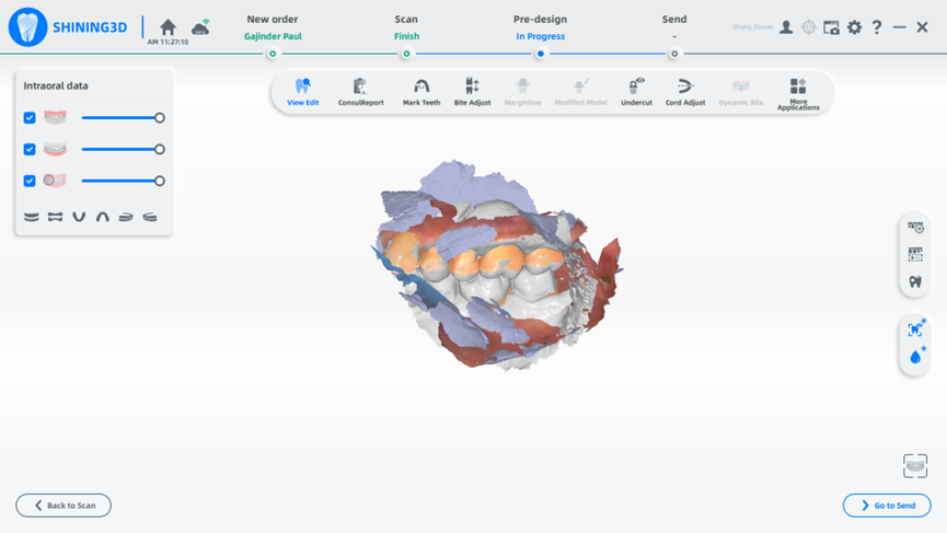 Shining 3D Aoralscan 3