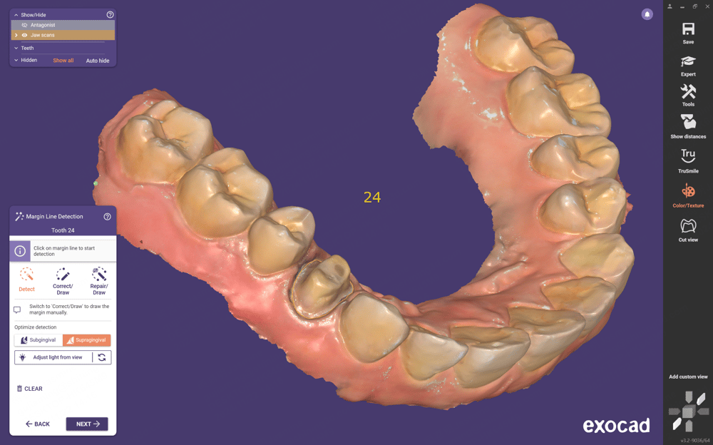 Shining 3D Aoralscan 3